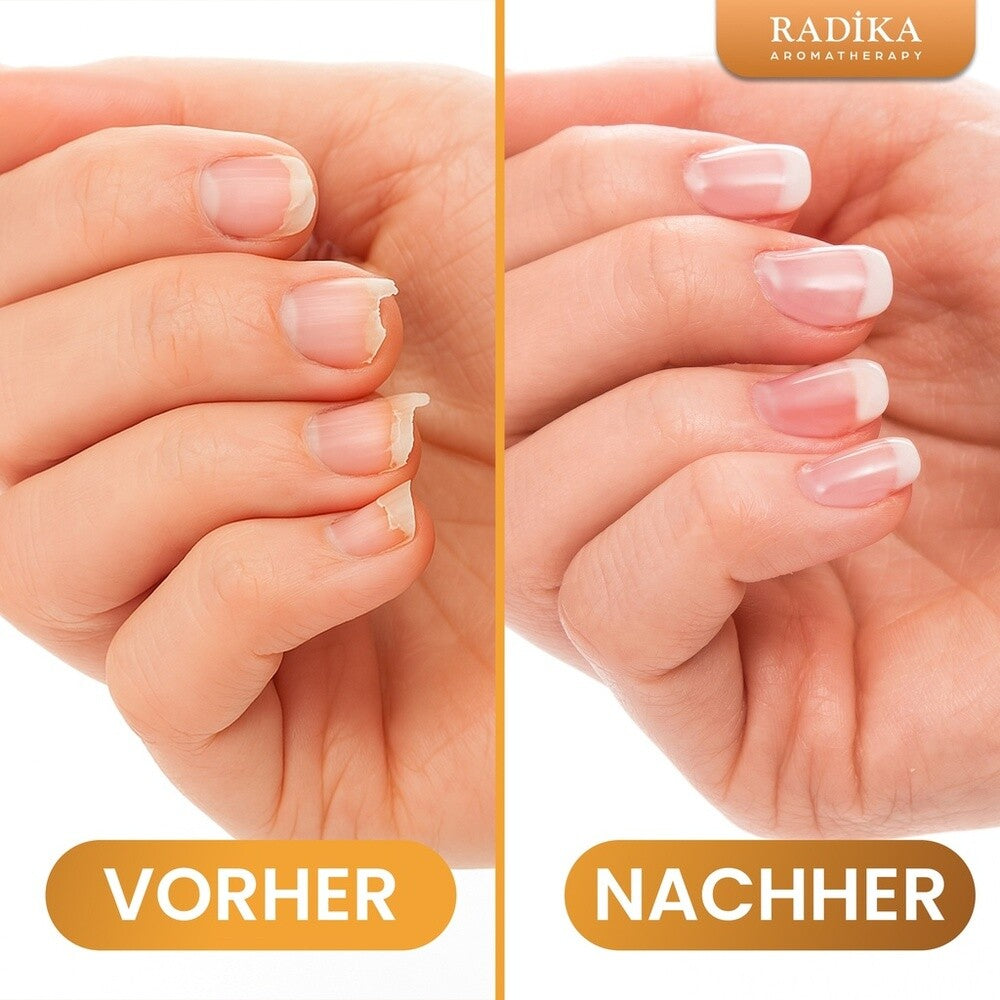 Nagelöle, Nagelpflege, Handcreme, 100% Rein, BIO, natürlich, 10 ml