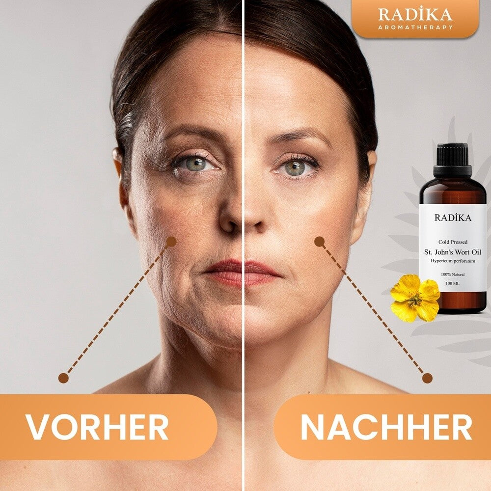 St John'S Wort Oil, Johanniskrautöl, 100% Rein, BIO, natürlich, 100 ml