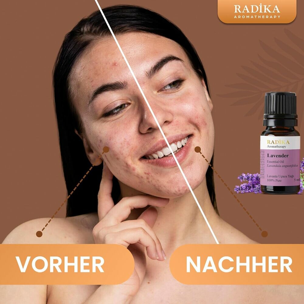 Lavendelöl, ätherisches Öl, 100% Rein, BIO, natürlich, 10 ml