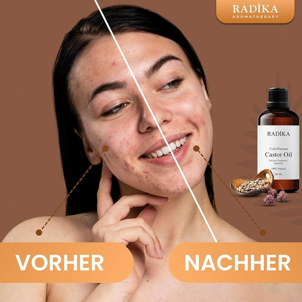 Rizinusöl, ätherisches Öl, 100% Rein, BIO, natürlich, 100 ml