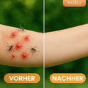 Citronella Repair Balsam natürliche Mückenstich- und Juckreizsalbe, BIO, 30 g