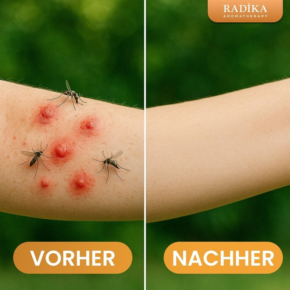 Citronella Repair Balsam natürliche Mückenstich- und Juckreizsalbe, BIO, 30 g