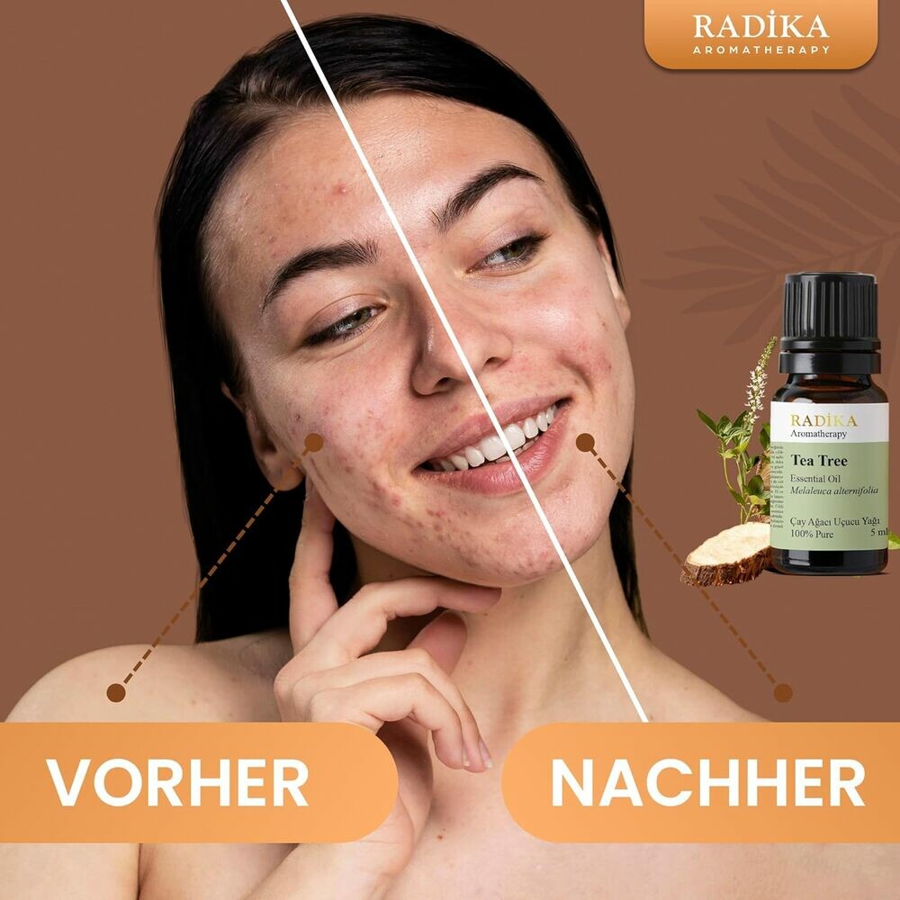 Teebaumöl, ätherisches Öl, 100% Rein, BIO, natürlich, 10 ml